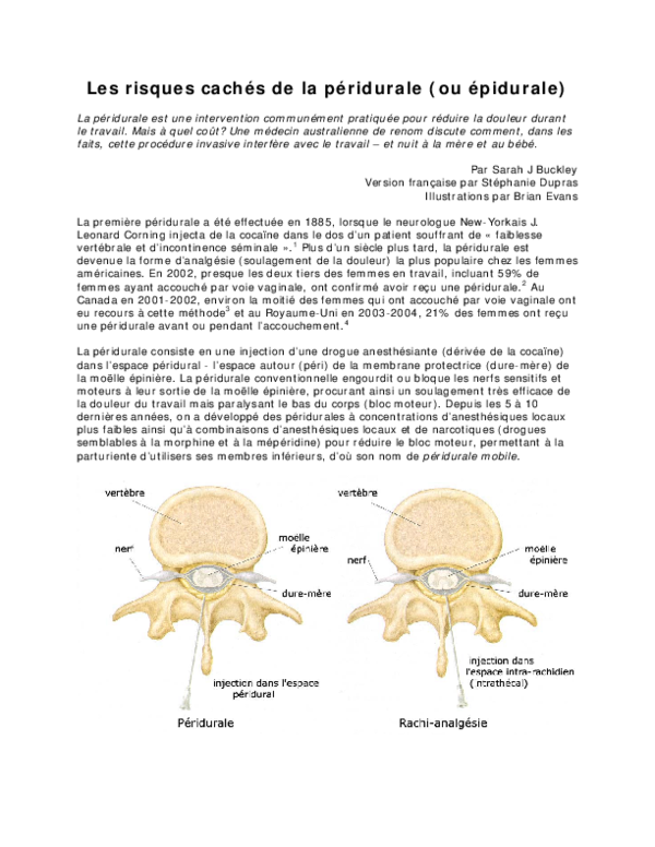 Les risques cachés de la péridurale (ou épidurale