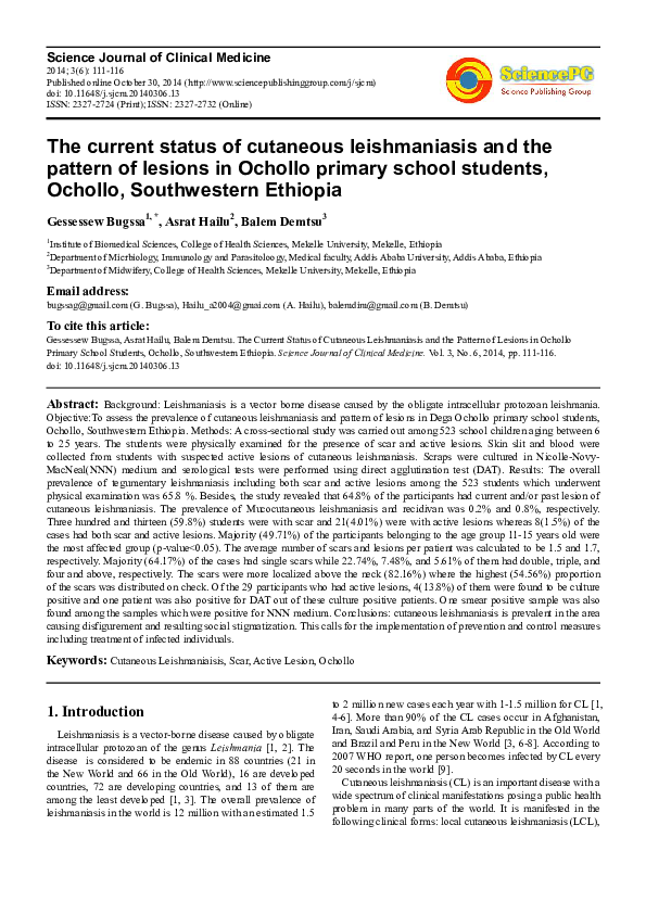 What is leishmaniasis image