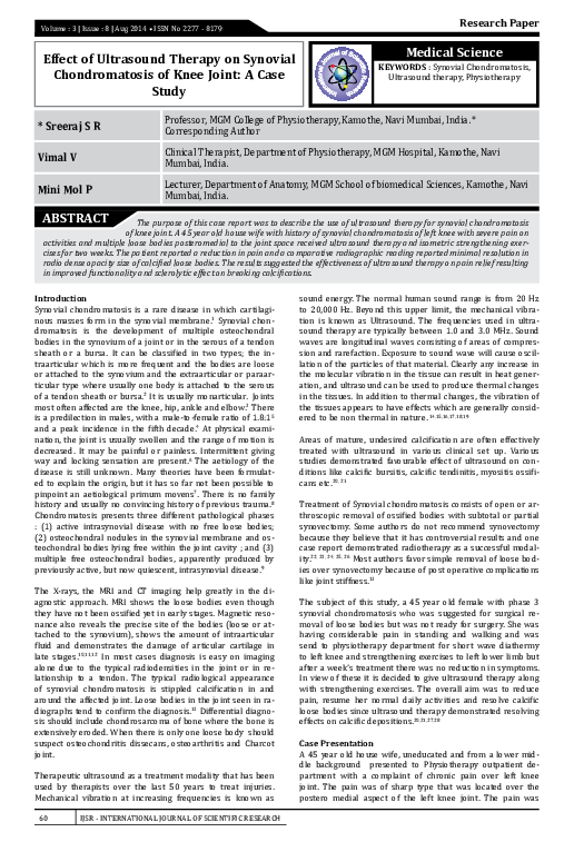 Therapeutic ultrasound device picture