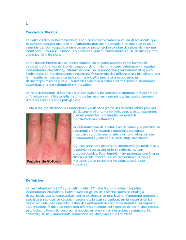 etiologia de la miositis