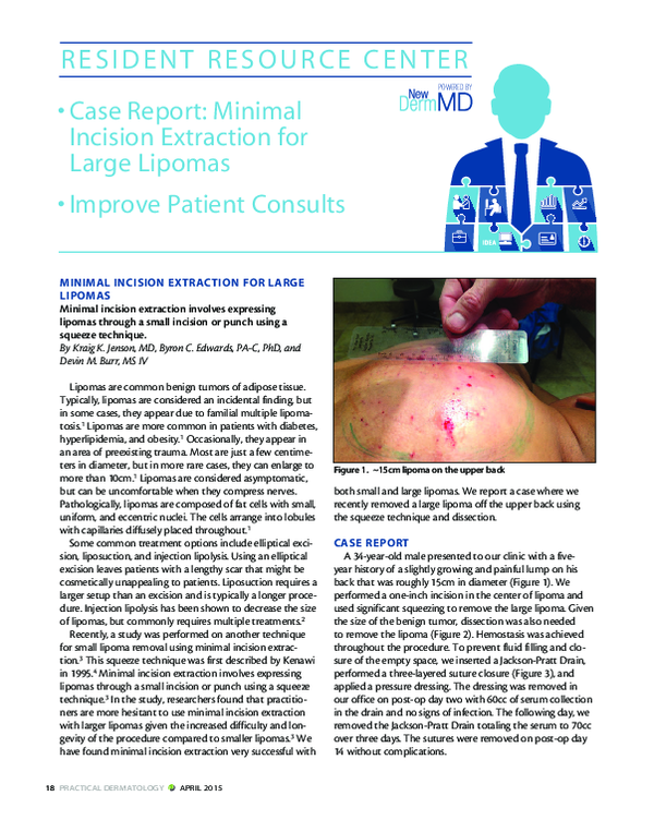 (PDF) Case Report: Minimal Incision Extraction for Large Lipomas