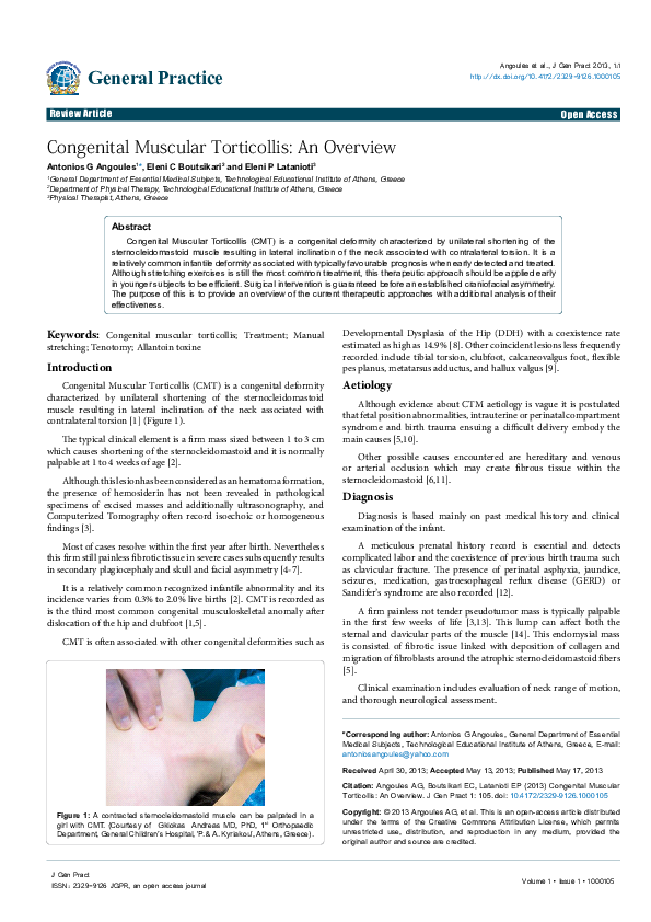 Torticollis handout pdf image