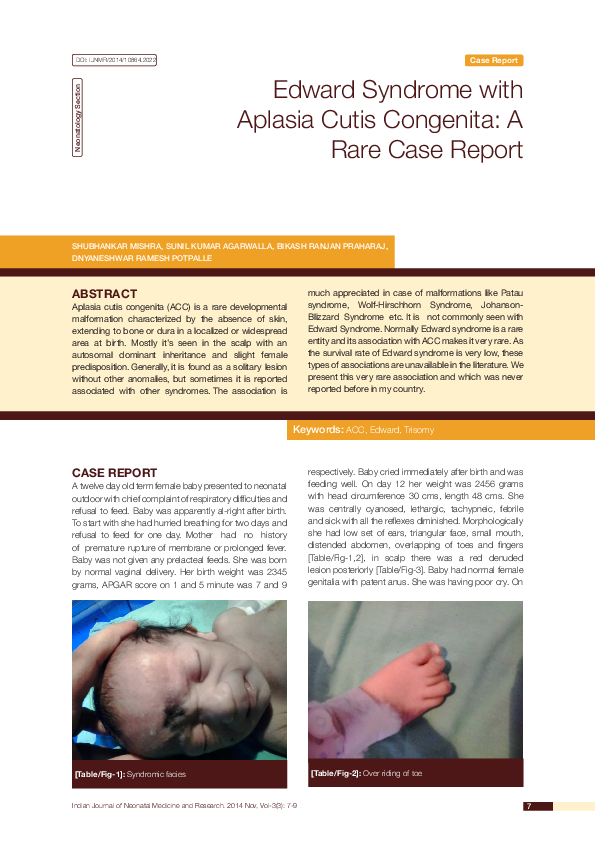 (PDF) Edward Syndrome with Aplasia Cutis Congenita A Rare Case Report