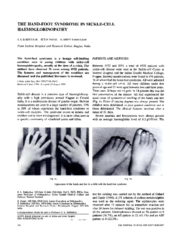 (PDF) THE HANDFOOT SYNDROME IN SICKLECELL HAEMOGLOBINOPATHY Ketan