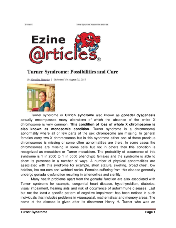(PDF) Turner Syndrome Possibilities and Cure Navodita Maurice