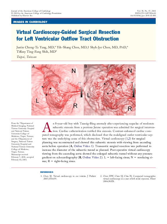(PDF) Virtual Cardioscopy-Guided Surgical Resection for Left ...