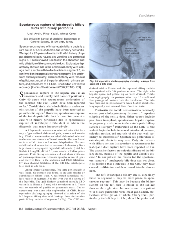 (PDF) Spontaneous rupture of intrahepatic biliary ducts with biliary ...