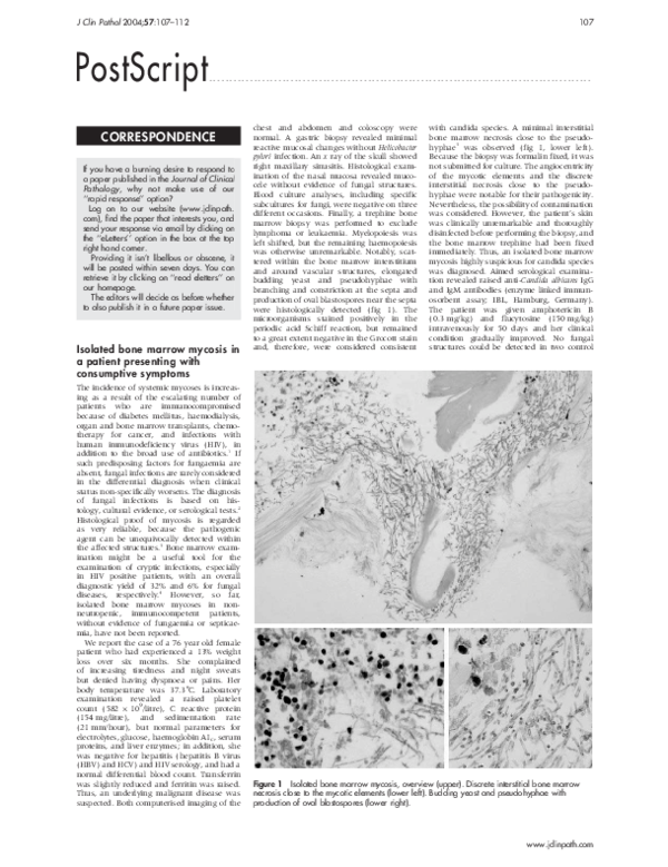 (PDF) The role of mast cells in bone marrow diseases