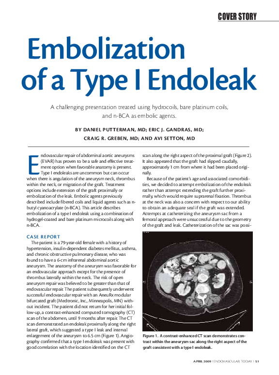 (PDF) Embolization of a Type I Endoleak A challenging presentation
