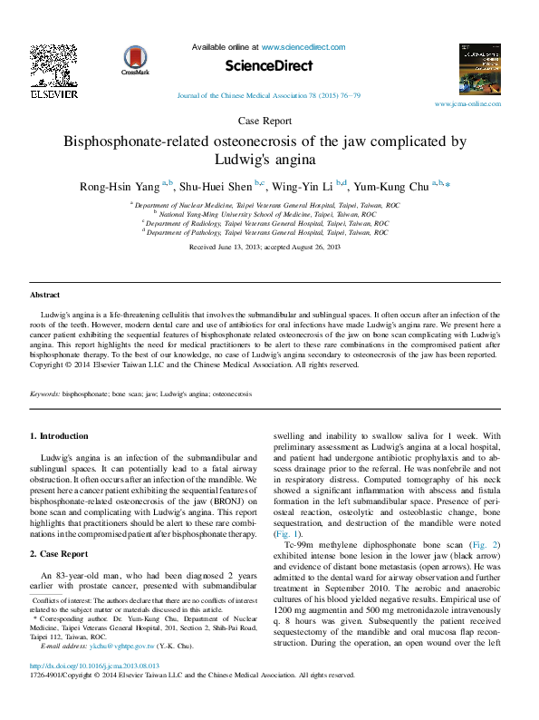 (PDF) Bisphosphonate-related osteonecrosis of the jaw complicated by ...