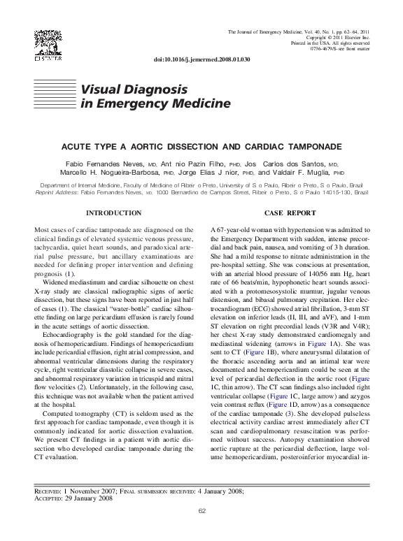 (PDF) Acute Type a Aortic Dissection and Cardiac Tamponade