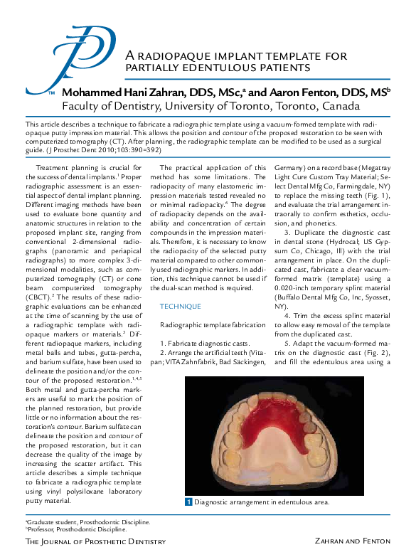 Implant related thesis 05 image