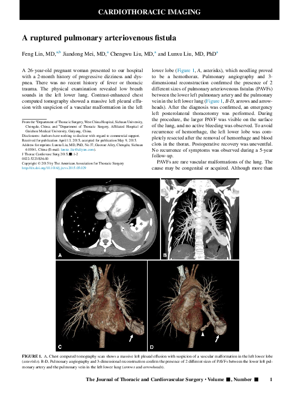 (PDF) A ruptured pulmonary arteriovenous fistula
