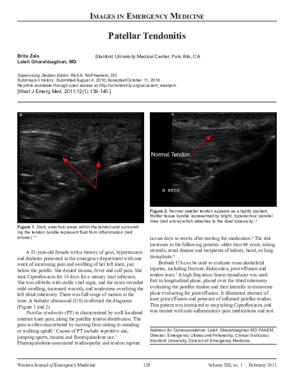 (PDF) Patellar tendonitis