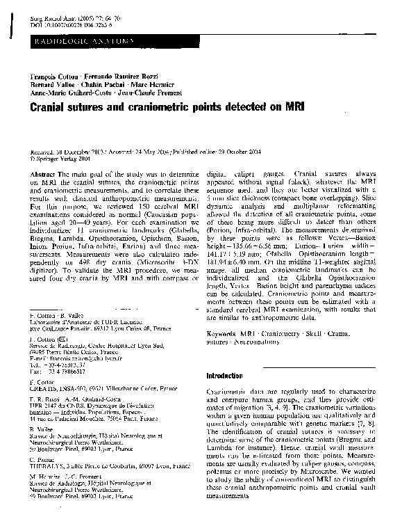 Etude chopin picture