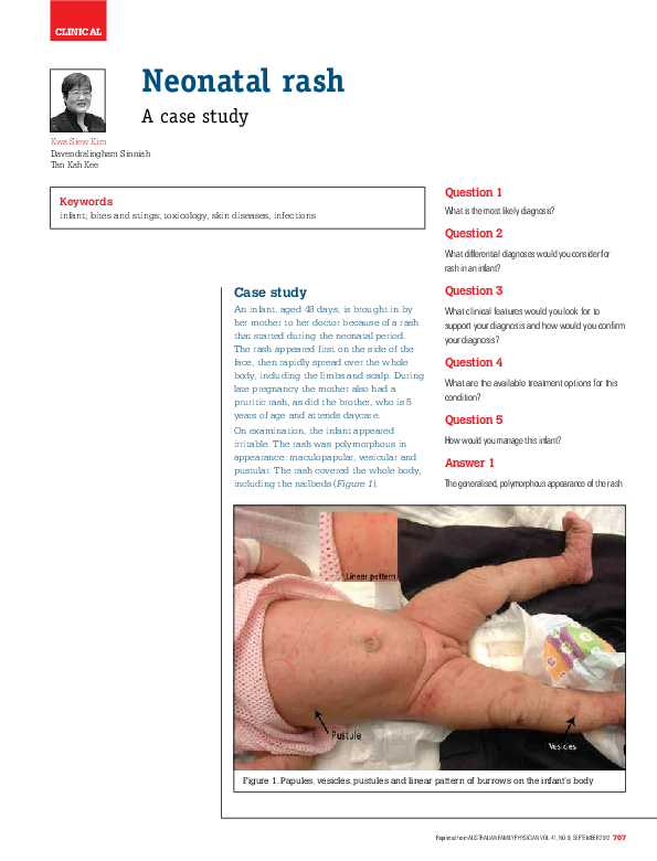 (PDF) Neonatal rash - a case study