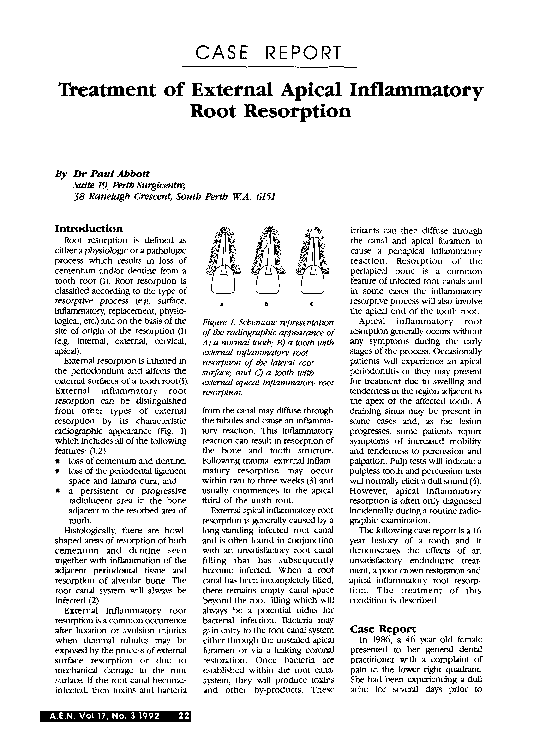 (PDF) Treatment of External Apical Inflammatory Root Resorption Paul