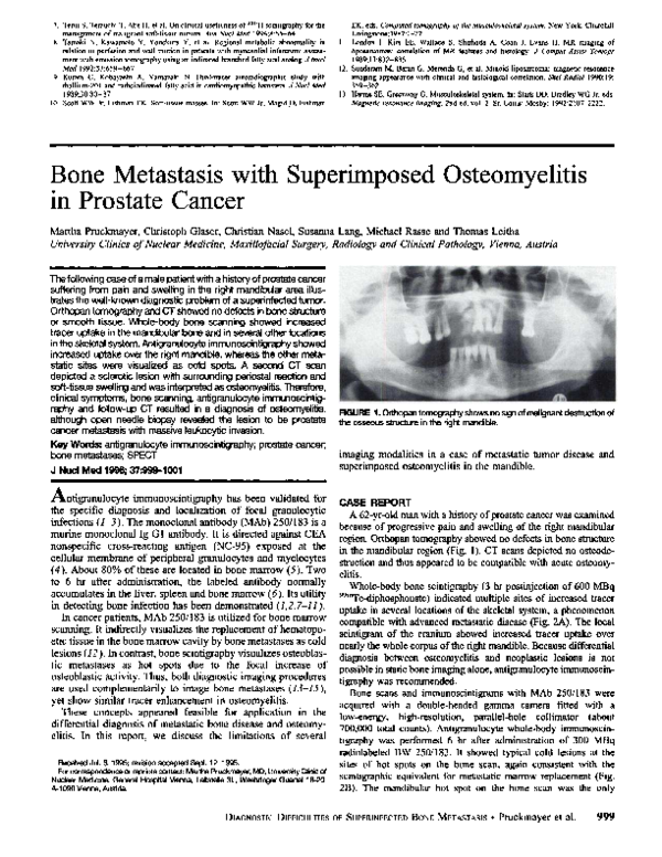 (PDF) Bone metastasis with superimposed osteomyelitis in prostate cancer