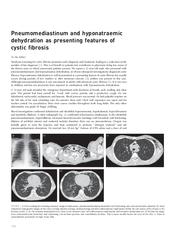 (PDF) Pneumomediastinum and hyponatraemic dehydration as presenting