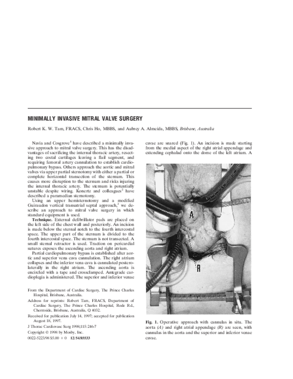 (PDF) Minimally invasive mitral valve surgery