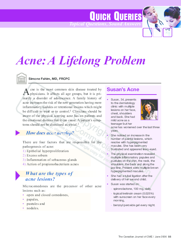 (PDF) Acne: A Lifelong Problem