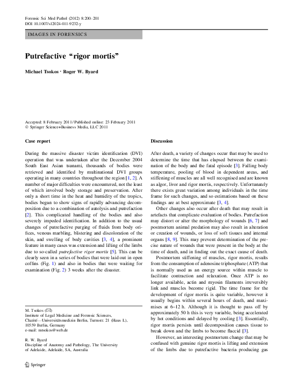 Rigor mortis essay image