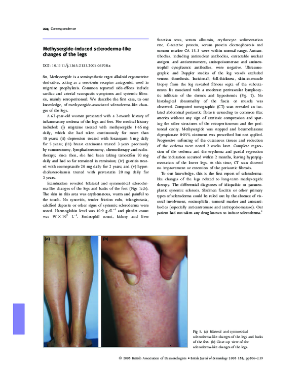 (PDF) Methysergide-induced scleroderma-like changes of the legs