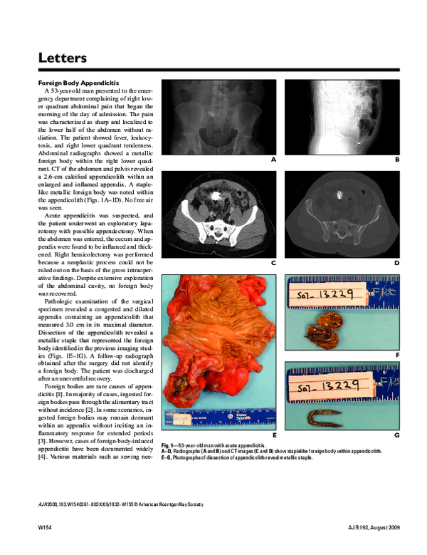 (PDF) Foreign-body appendicitis