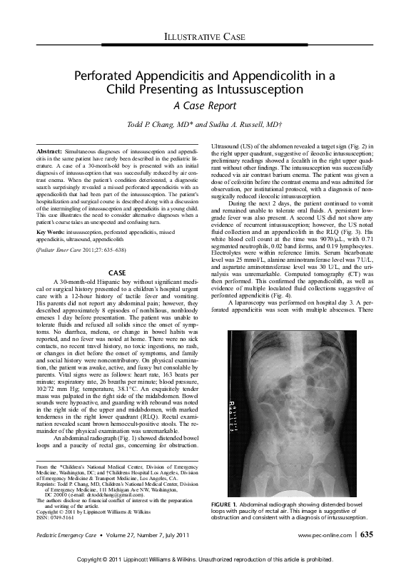 (PDF) Perforated appendicitis and appendicolith in a child presenting