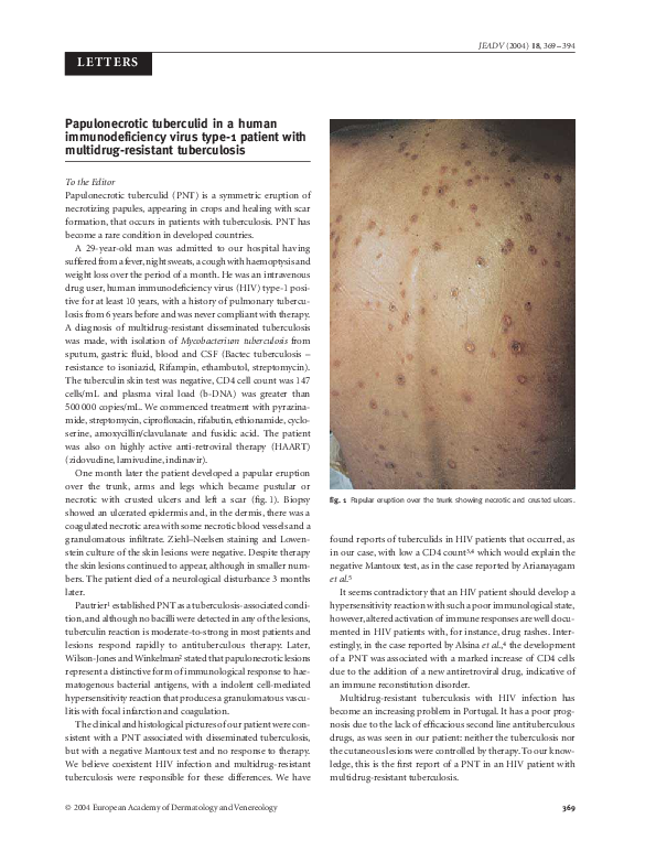 (PDF) Renal cell carcinoma with skin metastasis