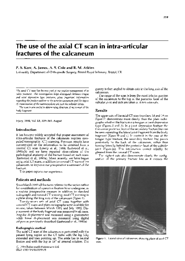 (PDF) The use of the axial CT scan in intra-articular fractures of the ...
