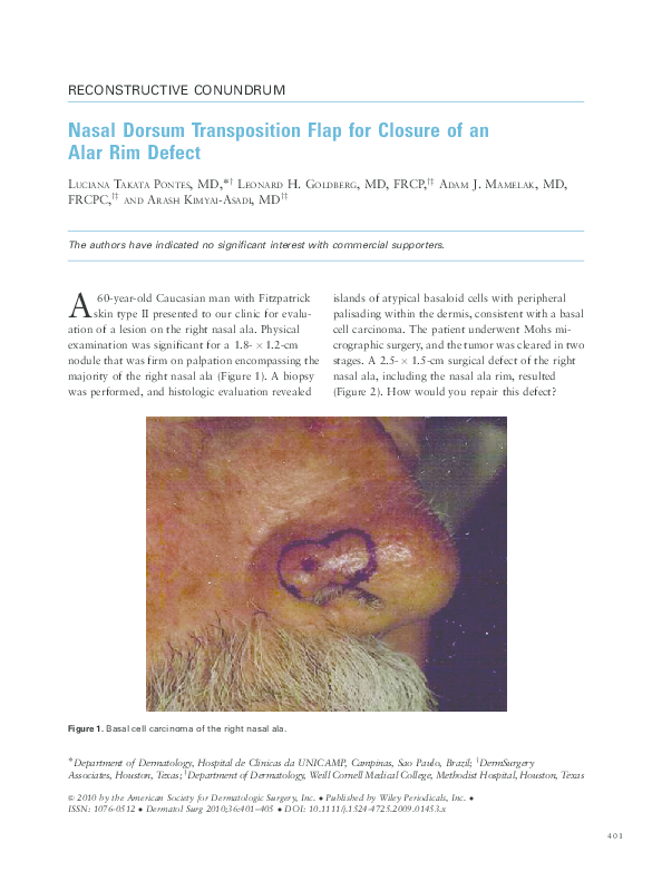 (PDF) Nasal Dorsum Transposition Flap for Closure of an Alar Rim Defect