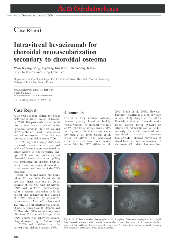 (PDF) Intravitreal bevacizumab for choroidal neovascularization ...