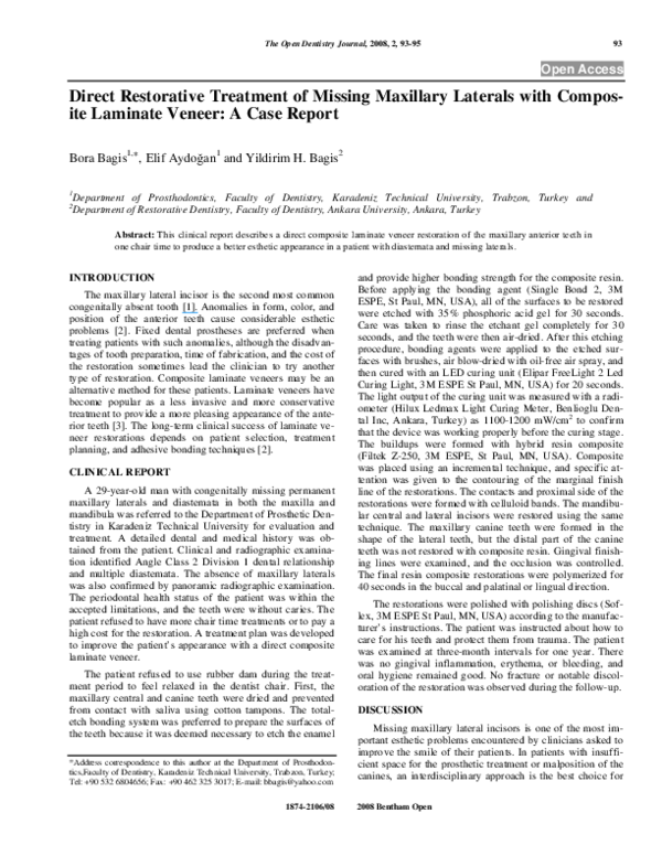 (PDF) Direct Restorative Treatment of Missing Maxillary Laterals with Composite Laminate Veneer