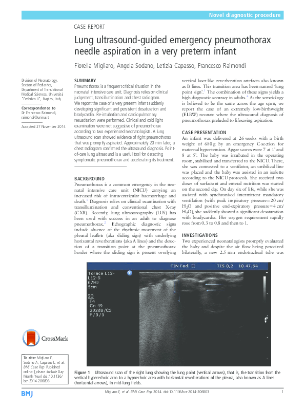 (PDF) Lung ultrasoundguided emergency pneumothorax needle aspiration