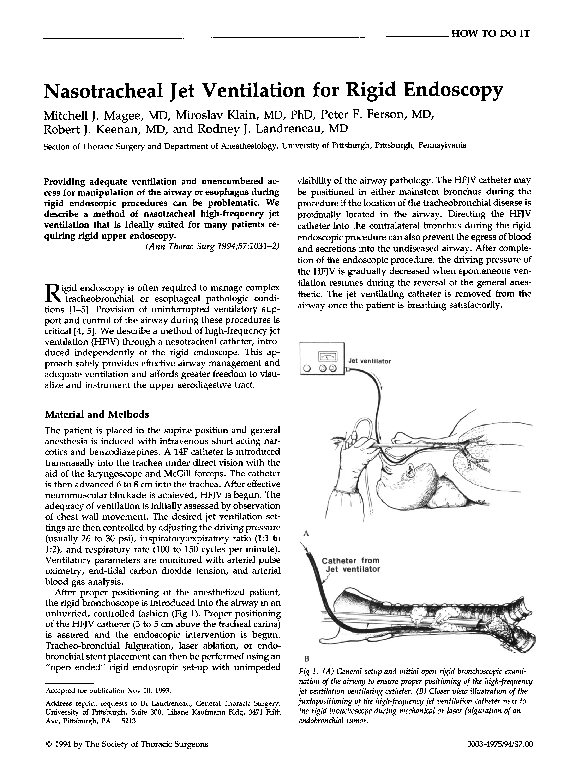 (PDF) Nasotracheal jet ventilation for rigid endoscopy Peter Ferson