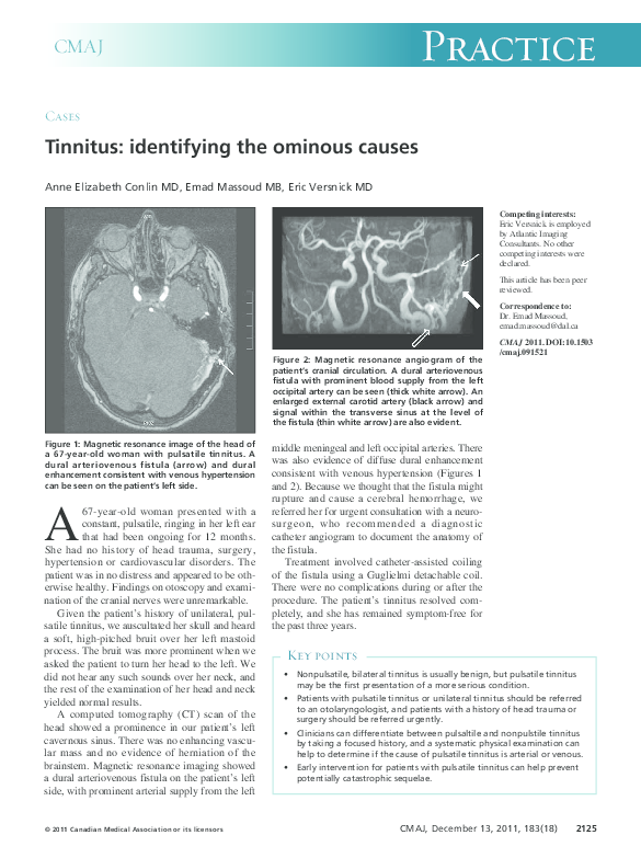 (PDF) Tinnitus: identifying the ominous causes