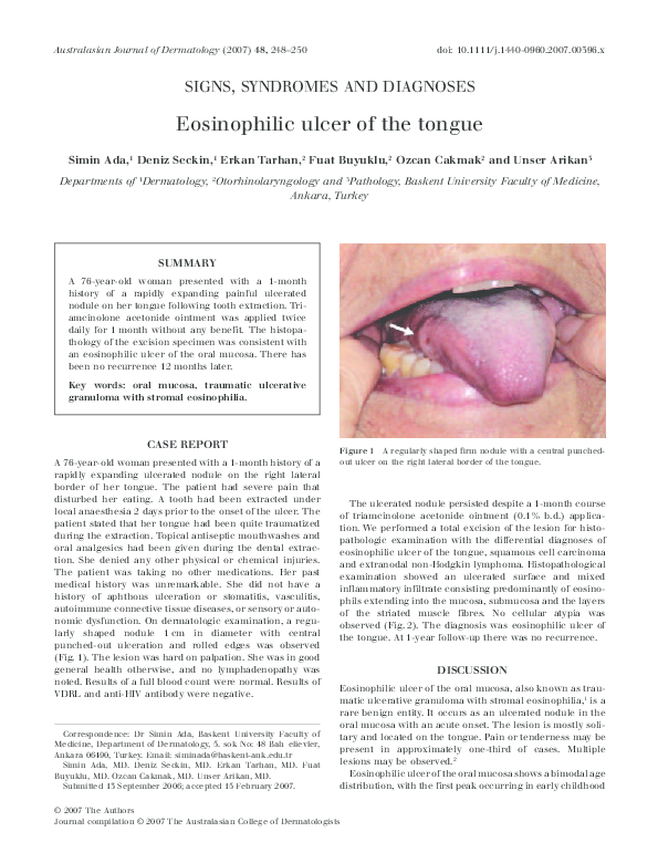 (PDF) Eosinophilic ulcer of the tongue