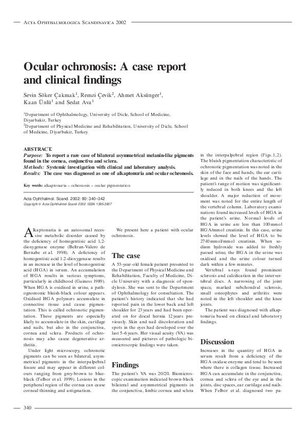 (PDF) Ocular ochronosis A case report and clinical findings Sevİn