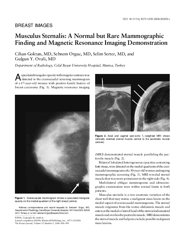 (PDF) Musculus Sternalis: A Normal but Rare Mammographic Finding and ...