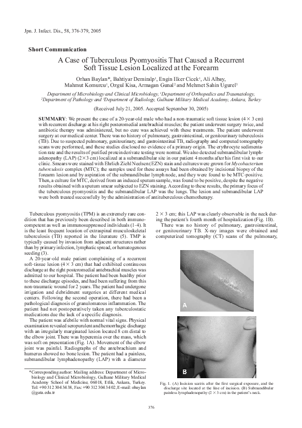 (PDF) A case of tuberculous pyomyositis that caused a recurrent soft ...