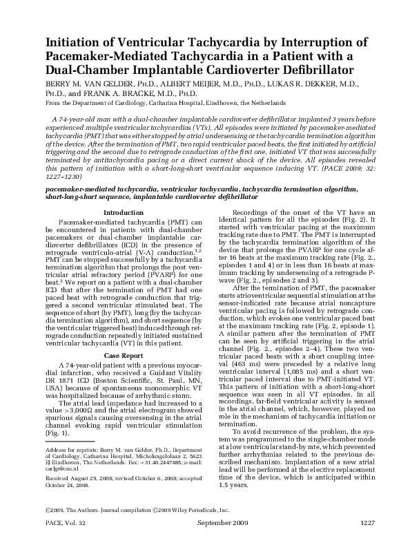 Ventricular tachycardia essay 06 picture