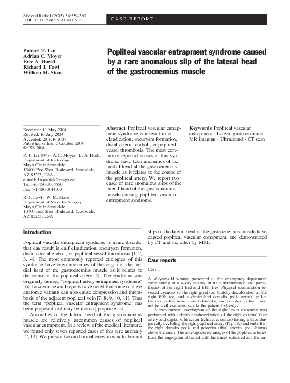 Entrapment defense image