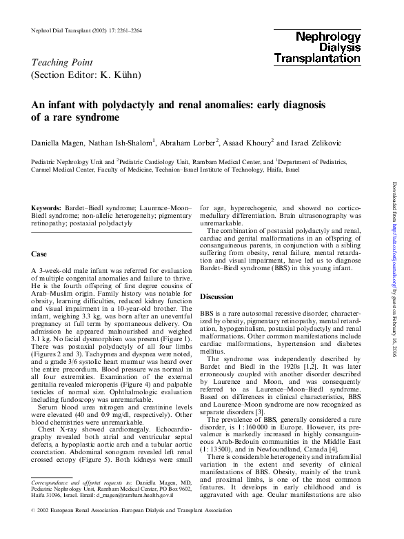 Polydactyl human image