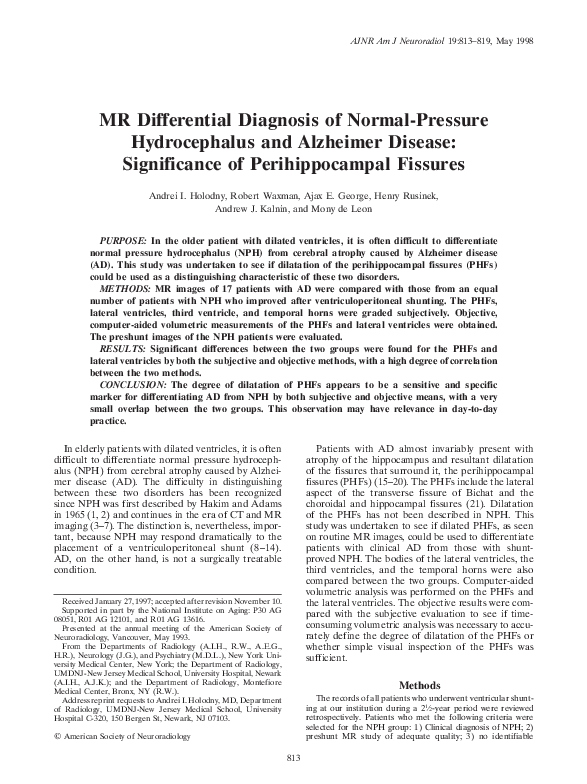 Hydrocephalus etiology picture