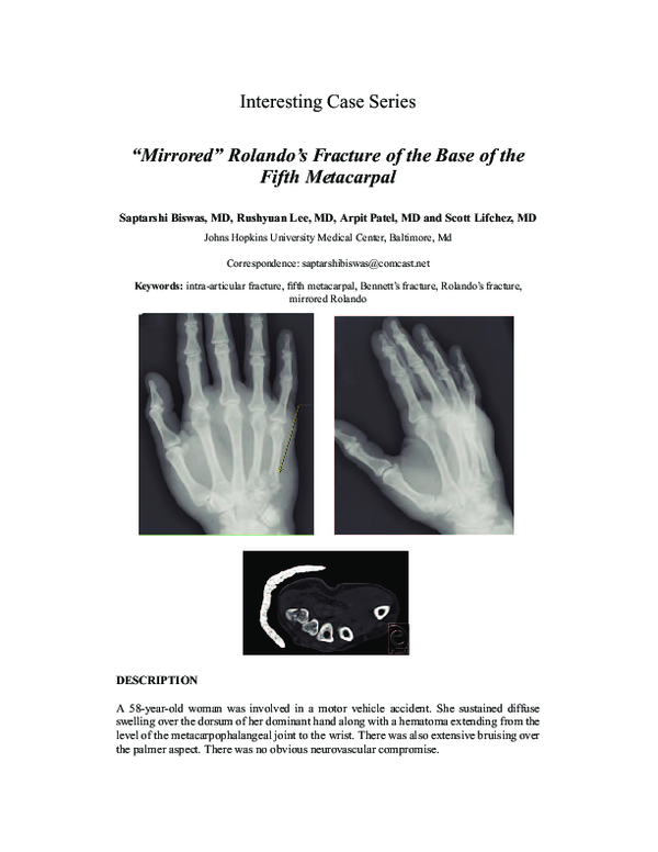 (PDF) Mirrored