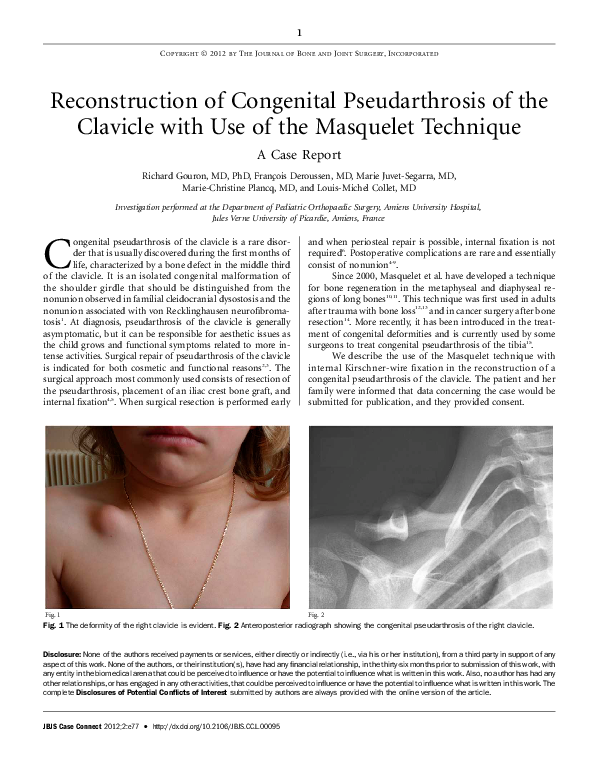 Technique de reconstruction