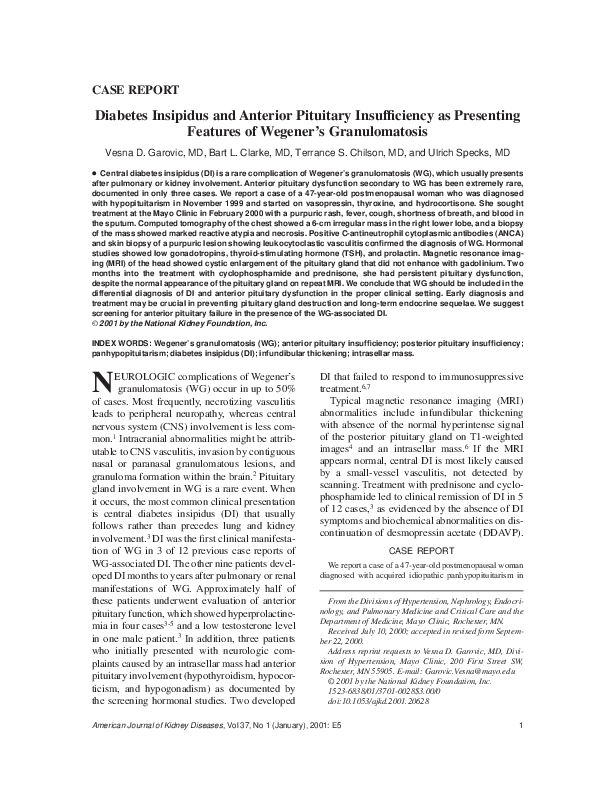 Diabetes insipidus investigation picture
