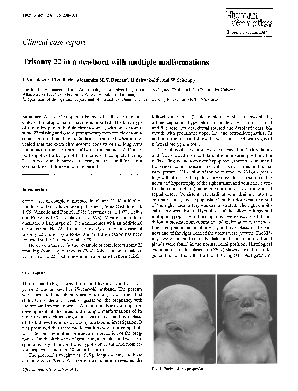 (PDF) Trisomy 22 in a newborn with multiple malformations Werner