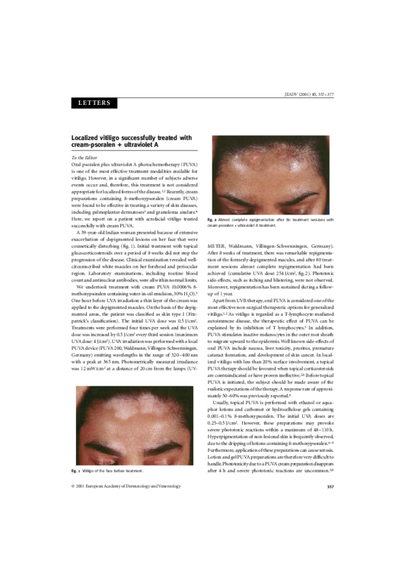 (PDF) Tintack' sign in a patient with cutaneous B-cell lymphoma